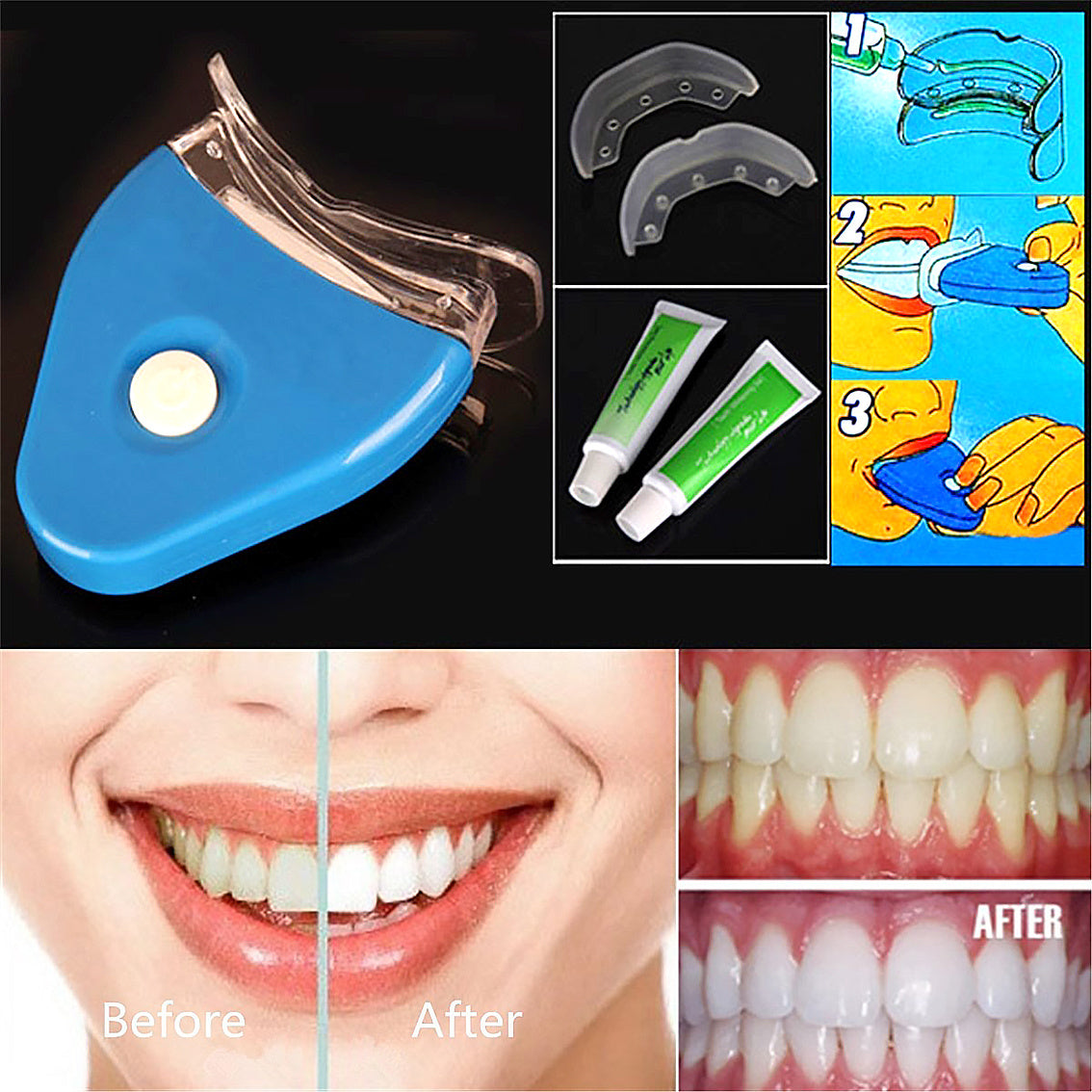 Teeth  Whitener